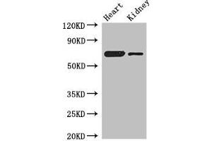 Western Blot Positive WB detected in: Mouse heart tissue, Mouse kidney tissue All lanes: ETFDH antibody at 3 μg/mL Secondary Goat polyclonal to rabbit IgG at 1/50000 dilution Predicted band size: 69, 63 kDa Observed band size: 69 kDa (ETFDH anticorps  (AA 34-617))