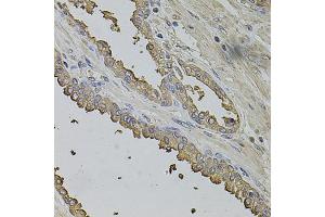Immunohistochemistry of paraffin-embedded human prostate using FMR1NB antibody (ABIN1876396) at dilution of 1:100 (40x lens). (FMR1NB anticorps)