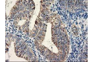 Image no. 2 for anti-DAN Domain Family, Member 5 (DAND5) (AA 23-189) antibody (ABIN1491235) (DAND5 anticorps  (AA 23-189))