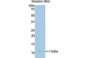 Detection of Recombinant FcgR3A, Human using Polyclonal Antibody to Fc Fragment Of IgG Low Affinity IIIa Receptor (FcgR3A)