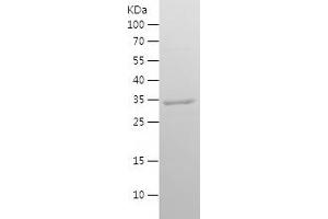 Western Blotting (WB) image for Prolactin-Induced Protein (PIP) (AA 29-146) protein (His-IF2DI Tag) (ABIN7124588) (PIP Protein (AA 29-146) (His-IF2DI Tag))