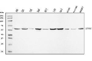 Western blot analysis of KPNA2 using anti-KPNA2 antibody (ABIN7601936).