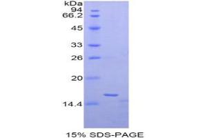 SDS-PAGE analysis of Human Matrix Gla Protein. (MGP Protéine)
