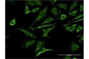 Immunofluorescence of monoclonal antibody to OCLN on HeLa cell. (Occludin anticorps  (AA 423-522))