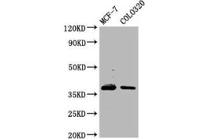 Western Blot Positive WB detected in: MCF-7 whole cell lysate, Colo320 whole cell lysate All lanes: PGLYRP3 antibody at 4. (PGLYRP3 anticorps  (AA 90-222))