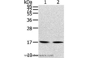 Western blot analysis of Human normal liver tissue and hepg2 cell, using RPLP1 Polyclonal Antibody at dilution of 1:400 (RPLP1 anticorps)