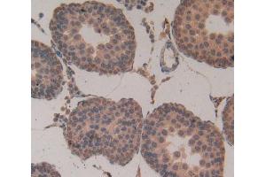 Used in DAB staining on fromalin fixed paraffin- embedded testis tissue