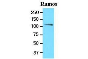 Cell lysates of Ramos (20 ug) were resolved by SDS-PAGE, transferred to nitrocellulose membrane and probed with anti-human NFATc1 (1:1000).