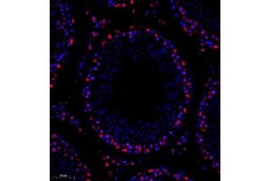 Immunofluorescence of paraffin embedded rat testis using TBCldl (ABIN7075843) at dilution of 1:1000 (250x lens)