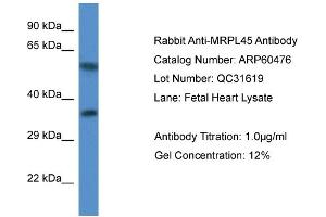 Western Blotting (WB) image for anti-Mitochondrial Ribosomal Protein L45 (MRPL45) (C-Term) antibody (ABIN2788460)