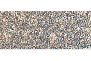 Immunohistochemistry of paraffin-embedded Human tonsil tissue using PRKRA Polyclonal Antibody at dilution of 1:65(x200) (PRKRA anticorps)