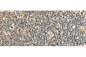 Immunohistochemistry of paraffin-embedded Human tonsil tissue using PRKRA Polyclonal Antibody at dilution of 1:65(x200) (PRKRA anticorps)