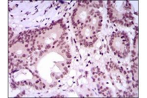 Immunohistochemistry (IHC) image for anti-Myocyte Enhancer Factor 2C (MEF2C) (AA 1-125) antibody (ABIN1846463) (MEF2C anticorps  (AA 1-125))