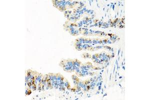 Immunohistochemistry of paraffin-embedded mouse lung using RGS5 antibody at dilution of 1:100 (x40 lens).