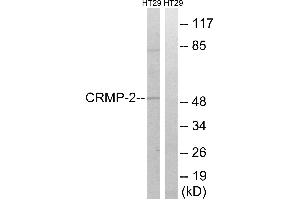 Immunohistochemistry analysis of paraffin-embedded human brain tissue using CRMP-2 (Ab-509) antibody. (DPYSL2 anticorps  (Thr509))