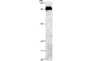 Western blot analysis of Mouse brain tissue, using APP Polyclonal Antibody at dilution of 1:1000 (beta Amyloid anticorps)
