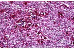 Human Brain, Cortex: Formalin-Fixed, Paraffin-Embedded (FFPE) (HMX2 anticorps  (AA 125-224))