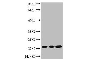 Western blot analysis of 1) MCF7, 2) Rat Kidney Tissue, 3) Mouse Brain Tissue, diluted at 1:2000. (Peroxiredoxin 1 anticorps)