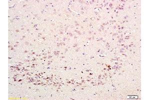 Formalin-fixed and paraffin embedded rat brain labeled with Rabbit Anti-CDK5 Polyclonal Antibody  at 1:200 followed by conjugation to the secondary antibody and DAB staining. (CDK5 anticorps  (AA 15-100))
