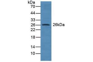 Figure. (GSTA4 anticorps  (AA 3-222))
