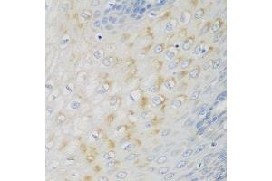Immunohistochemistry of paraffin-embedded human esophagus using NME4 antibody.