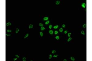 Immunofluorescence staining of Hela cells with ABIN7127547 at 1:22, counter-stained with DAPI.