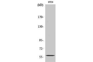 Western Blotting (WB) image for anti-Cytochrome P450, Family 2, Subfamily J, Polypeptide 2 (CYP2J2) (Internal Region) antibody (ABIN3184188)