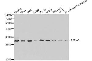 Western blot analysis of extracts of various cell lines, using PSMA6 antibody (ABIN6292835) at 1:1000 dilution. (PSMA6 anticorps)