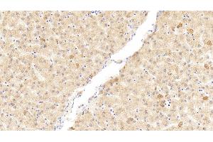 Detection of WNK1 in Human Liver Tissue using Polyclonal Antibody to WNK Lysine Deficient Protein Kinase 1 (WNK1)