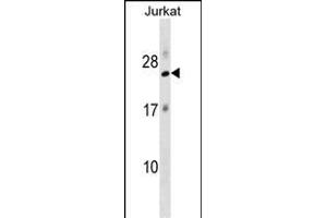 RPL18 Antibody (N-term) (ABIN1538828 and ABIN2849097) western blot analysis in Jurkat cell line lysates (35 μg/lane). (RPL18 anticorps  (N-Term))
