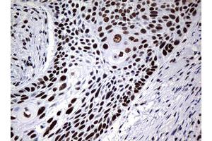 Image no. 7 for anti-Nibrin (NBN) (AA 183-460) antibody (ABIN1491059)