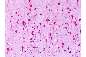 Anti-GPR1 antibody IHC of human brain, neurons. (G Protein-Coupled Receptor 1 anticorps  (N-Term))