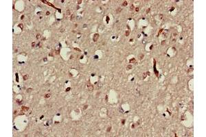Immunohistochemistry of paraffin-embedded human brain tissue using ABIN7160025 at dilution of 1:100 (MAP3K13 anticorps  (AA 506-835))