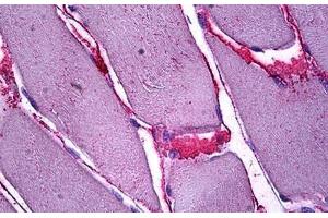 Human Skeletal Muscle, Interstitial Cells: Formalin-Fixed, Paraffin-Embedded (FFPE) (SFRP4 anticorps  (AA 239-253))