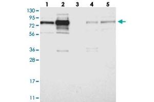 Western blot analysis of Lane 1: RT-4, Lane 2: U-251 MG, Lane 3: Human Plasma, Lane 4: Liver, Lane 5: Tonsil with GRAMD1C polyclonal antibody . (GRAMD1C anticorps)