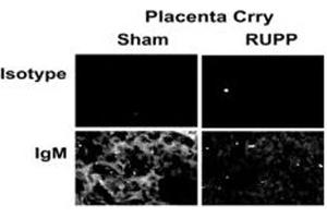 Complement regulators Crry, CD55 and CD59 change in placenta and kidney cortex in RUPP compared to Sham animals.