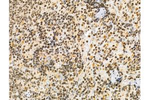 ABIN6261079 and ABIN6276536 at 1/100 staining Rat spleen tissue by IHC-P.