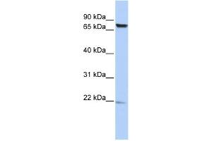 WB Suggested Anti-C7orf38 Antibody Titration: 0.