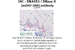 Image no. 2 for anti-Deoxyribonuclease II, Lysosomal (DNASE2) (AA 347-360) antibody (ABIN1733721) (DNASE2 anticorps  (AA 347-360))