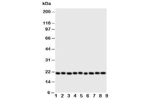 Western blot testing of Cytoglobin antibody and Lane 1:  rat brain (CYGB anticorps  (N-Term))