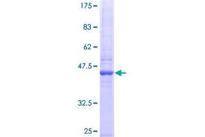Image no. 1 for Tumor Necrosis Factor (Ligand) Superfamily, Member 14 (TNFSF14) (AA 1-177) protein (GST tag) (ABIN1323229)