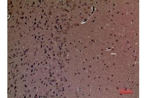 Immunohistochemistry (IHC) analysis of paraffin-embedded Mouse Brain, antibody was diluted at 1:100. (INPPL1 anticorps  (Internal Region))