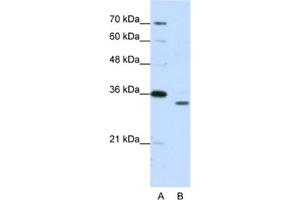 Western Blotting (WB) image for anti-Proteasome Subunit alpha Type 1 (PSMA1) antibody (ABIN2462129) (PSMA1 anticorps)