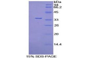 SDS-PAGE (SDS) image for Pyruvate Dehydrogenase Kinase, Isozyme 4 (PDK4) (AA 117-387) protein (His tag) (ABIN2126594) (PDK4 Protein (AA 117-387) (His tag))