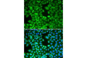 Immunofluorescence analysis of MCF-7 cell using RAN antibody. (RAN anticorps  (AA 1-216))