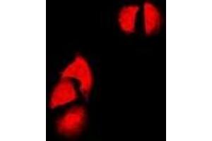 Immunofluorescent analysis of Cyclin D2 staining in SW480 cells.