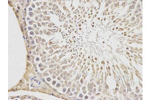 Immunohistochemistry (IHC) image for anti-Placenta Growth Factor (PGF) antibody (ABIN1874109) (PLGF anticorps)