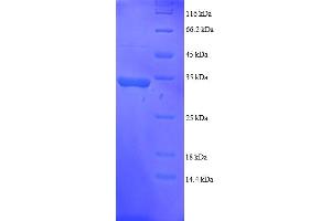 SDS-PAGE (SDS) image for Growth Arrest and DNA-Damage-Inducible, alpha (GADD45A) (AA 1-165), (full length) protein (His-SUMO Tag) (ABIN5709547)