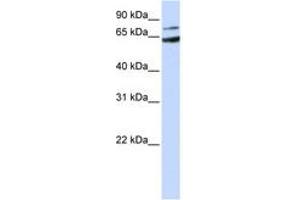 Image no. 1 for anti-Frizzled Family Receptor 8 (FZD8) (AA 144-193) antibody (ABIN6743056) (FZD8 anticorps  (AA 144-193))