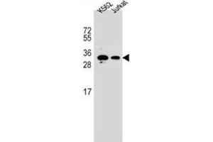 Western blot analysis of HOXA6 / HOX1B Antibody (Center) in K562, Jurkat cell line lysates (35ug/lane). (HOXA6 anticorps  (Middle Region))